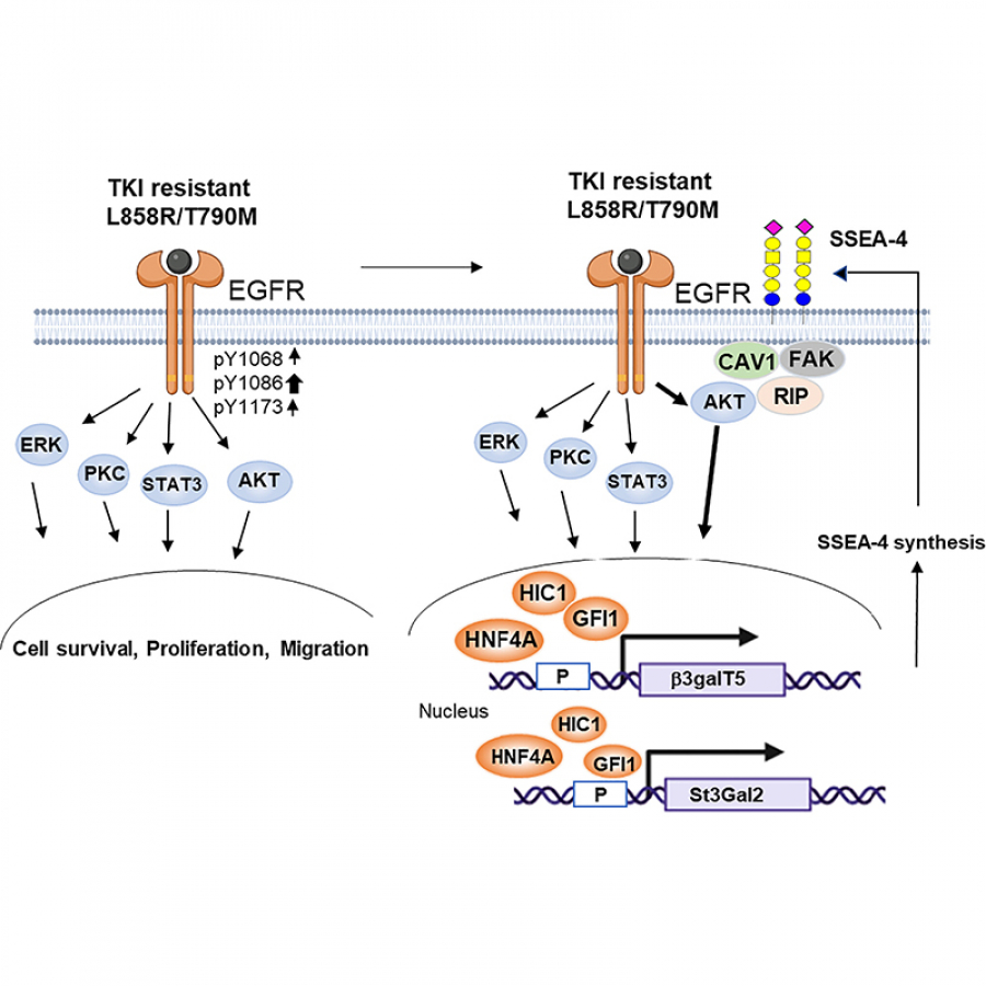 Increased expression of SSEA-4 on TKI-resistant non-small cell lung cancer  with EGFR-T790M mutation